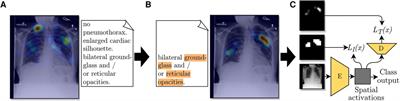 Localization supervision of chest x-ray classifiers using label-specific eye-tracking annotation